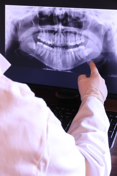 Best Emergency Tooth Extraction in Emporia, VA