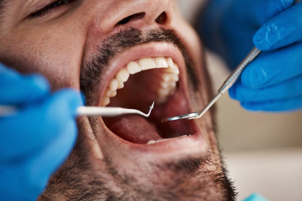 Best Emergency Treatment for Toothache in Emporia, VA