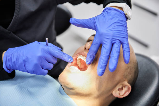 Best Emergency Treatment for Toothache in Emporia, VA
